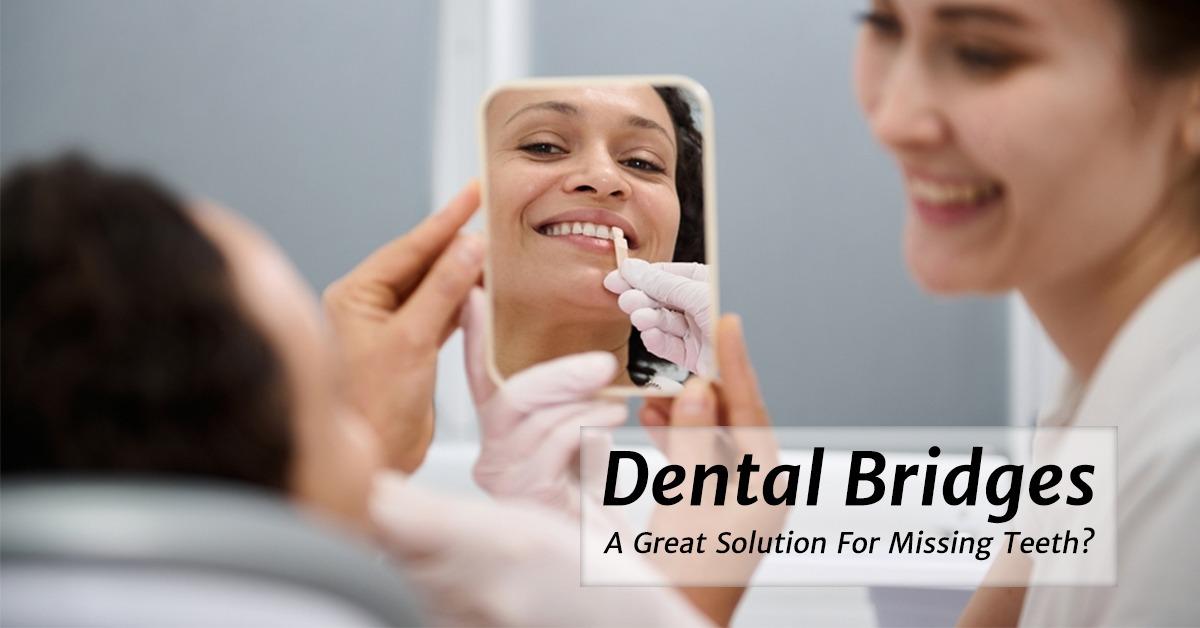 Dental Bridges – A Great Solution for Missing Teeth